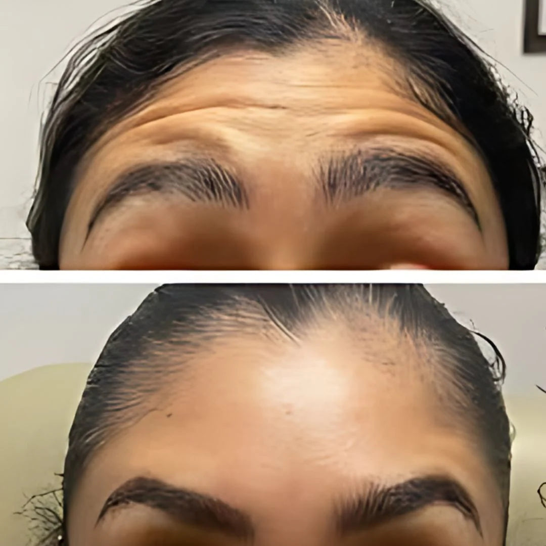 Crema Bótox Instantáneo - La Crema Antiedad