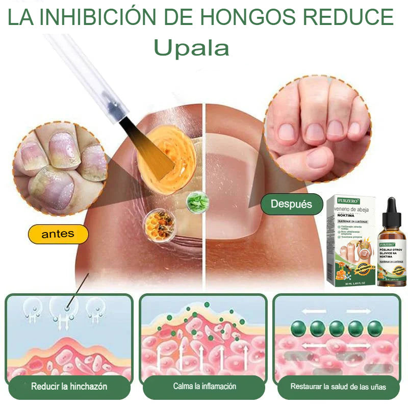 [COMPRA 1 LLEVA 2] Suero en Gotas Para Tratamiento de Los Hongos De Los Pies
