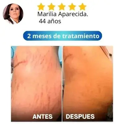 Descubre la crema reafirmante que há ayudado más de 30mil mujeres a transformar sus medidas!