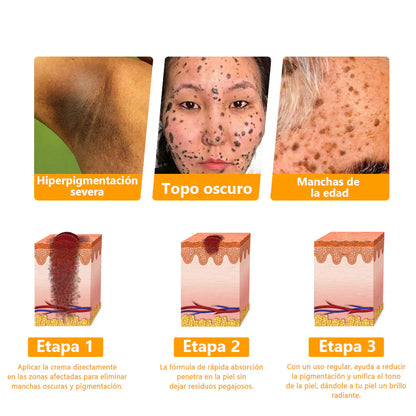 COMPRA 1 LLEVA 2 Elimina manchas, cicatrices y arrugas en solo 7 días con Lenaro Flow Secret™ – La fórmula avanzada para una piel perfecta⭐