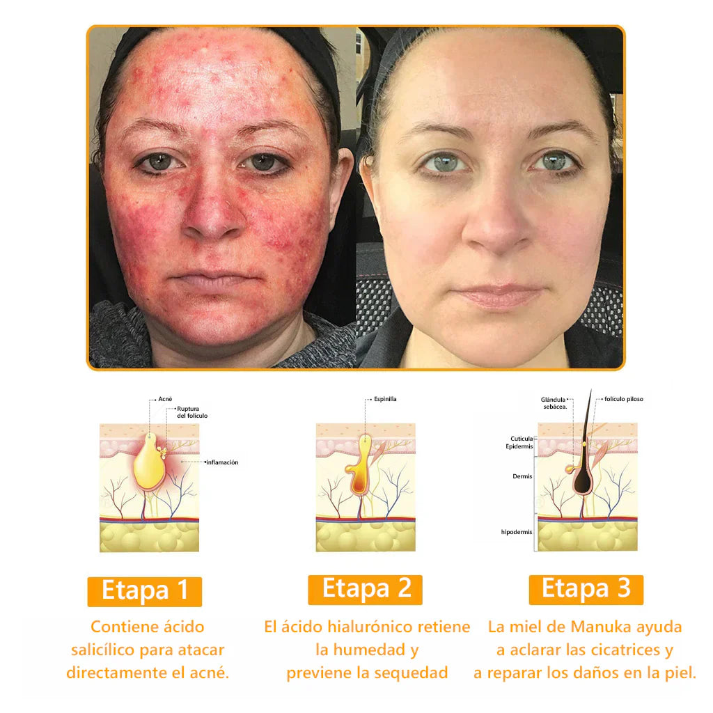 COMPRA 1 LLEVA 2 Elimina manchas, cicatrices y arrugas en solo 7 días con Lenaro Flow Secret™ – La fórmula avanzada para una piel perfecta⭐