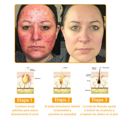 COMPRA 1 LLEVA 2 Elimina manchas, cicatrices y arrugas en solo 7 días con Lenaro Flow Secret™ – La fórmula avanzada para una piel perfecta⭐
