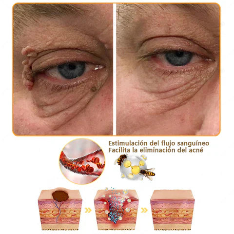 COMPRA 1 LLEVA 2 Elimina manchas, cicatrices y arrugas en solo 7 días con Lenaro Flow Secret™ – La fórmula avanzada para una piel perfecta⭐