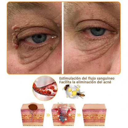 COMPRA 1 LLEVA 2 Elimina manchas, cicatrices y arrugas en solo 7 días con Lenaro Flow Secret™ – La fórmula avanzada para una piel perfecta⭐