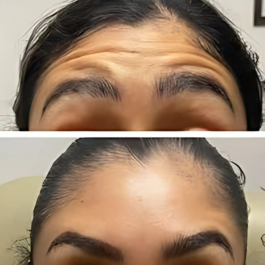 Crema Bótox Instantáneo - La Crema Antiedad