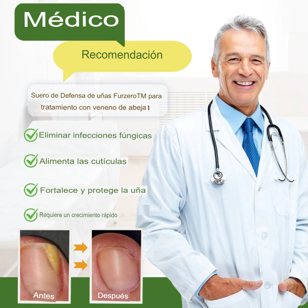 [COMPRA 1 LLEVA 2] Suero en Gotas Para Tratamiento de Los Hongos De Los Pies