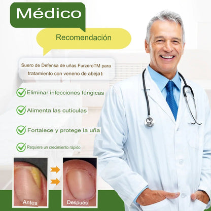 [COMPRA 1 LLEVA 2] Suero en Gotas Para Tratamiento de Los Hongos De Los Pies