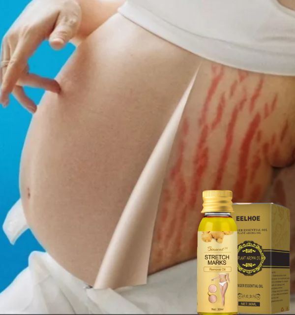 SERUM Renew Skin Repair™ Removedor de estrías