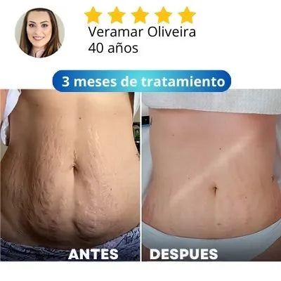 Descubra ahora Crema reafirmante que há ayudado más de 30mil Mujeres a transformar su autoestima! (Compra 1 LLEVA 2 + 2 Regalos )