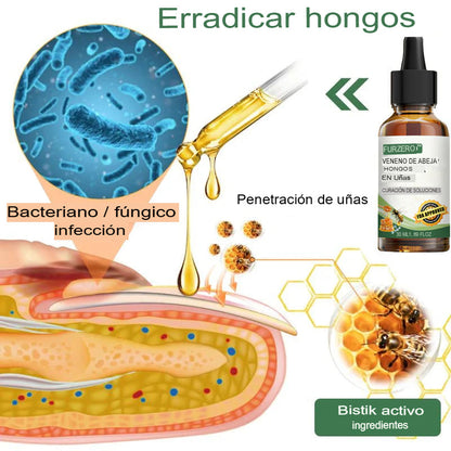 [COMPRA 1 LLEVA 2] Suero en Gotas Para Tratamiento de Los Hongos De Los Pies