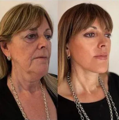 Descubra ahora Crema reafirmante que há ayudado más de 30mil Mujeres a transformar su autoestima! (Compra 1 LLEVA 2 + 2 Regalos )